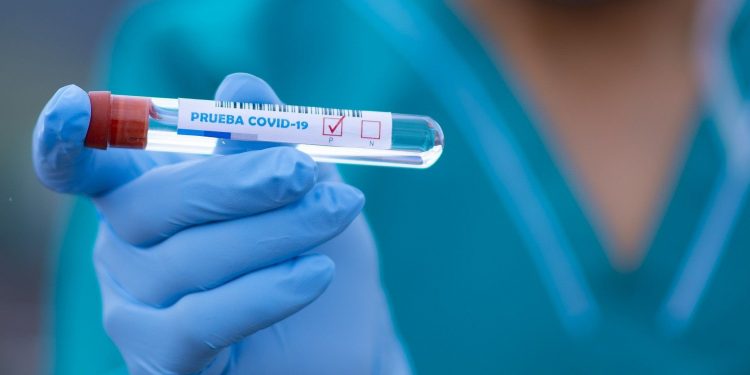 Viernes 1 de octubre: Guadalajara registra 11 nuevos contagios en las últimas 24 horas