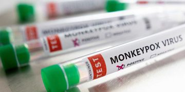 Primer caso de viruela del mono en Guadalajara