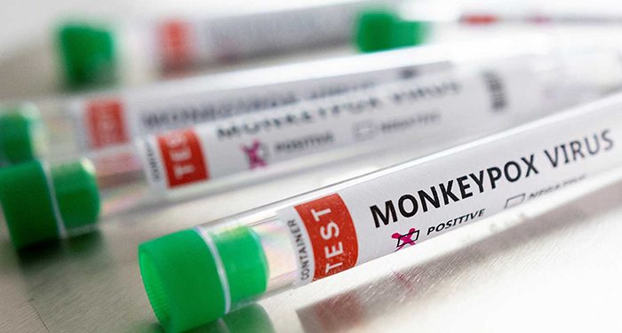 Primer caso de viruela del mono en Guadalajara
